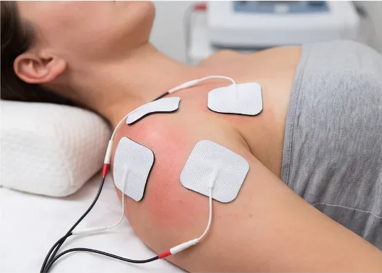 Interferential therapy electrodes on a shoulder