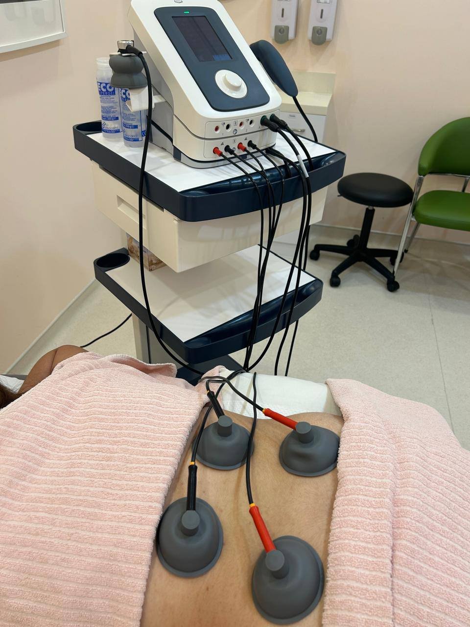 Interferential Therapy