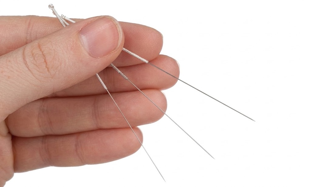 The effects of dry needling can vary depending on the severity and duration of myofascial pain