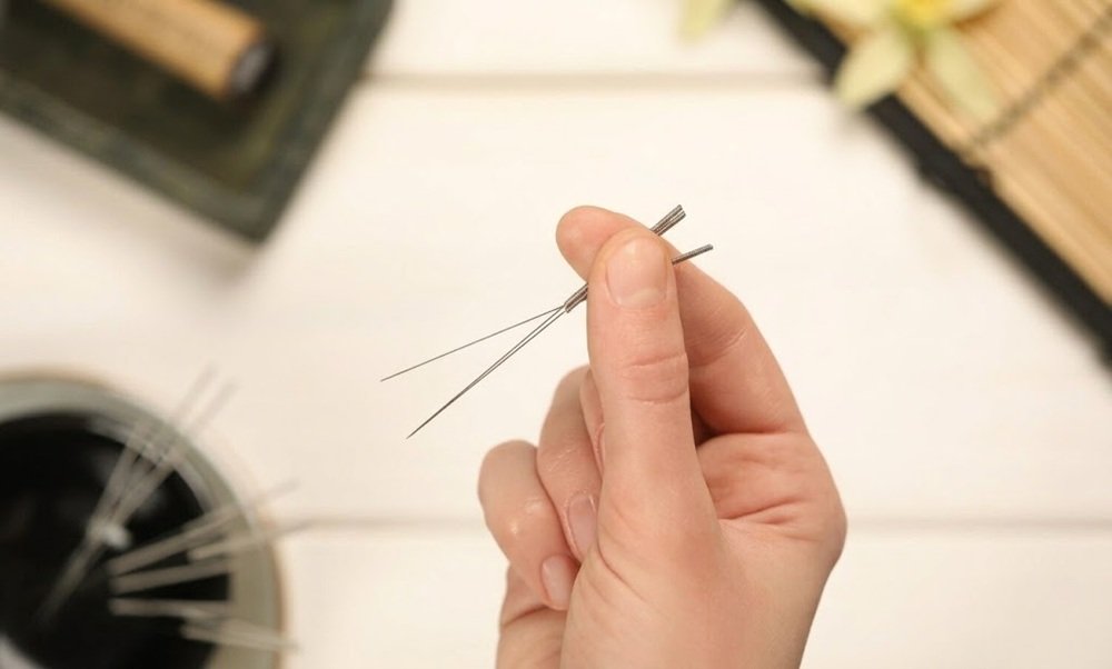 Dry needling treatment and potential benefits and risks