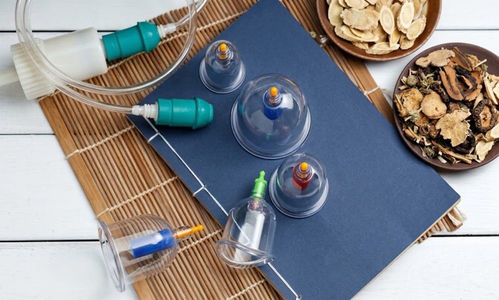 Cupping Therapy in Physiotherapy: Benefits & Uses