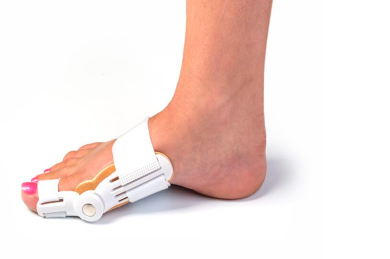 When Should You See a Doctor About Bunions?