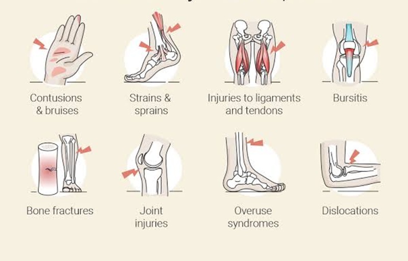 Experience With Sports Injuries