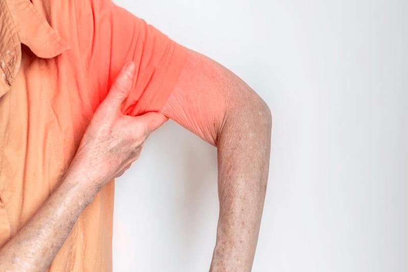 Frozen shoulder and limited movement