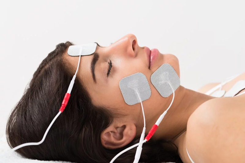 TENS therapy for Bell’s palsy